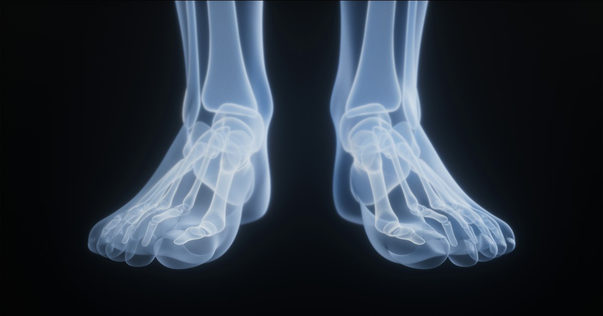 Dutasteride, cholesterol and bone health