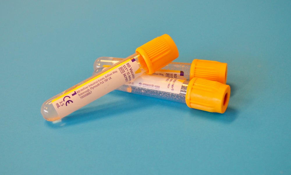 ACP-105: an experimental SARM